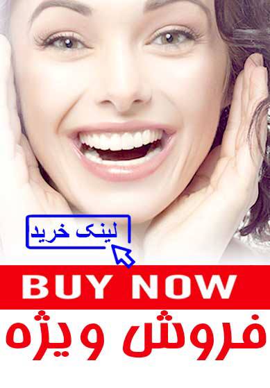 فروش ویژه بردنت